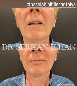 Image of Dr.Serkan Ilhan Gallery 3