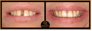 Image of Mokotooth Prestige Dental Gallery 1