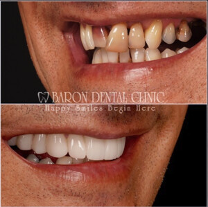 Image of Baron Dental Clinic Gallery 1