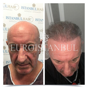 Image of Euro Istanbul Clinic Gallery 5