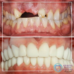 Image of Atalya Private Oral and Dental Health Polyclinic Gallery 0