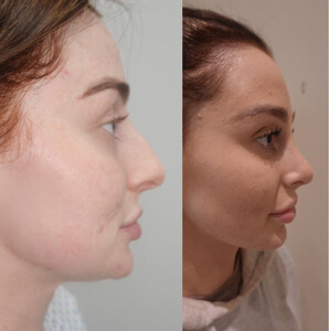 Image of Soho Clinic - Dr. Frati Cosmetic Surgeon Gallery 1