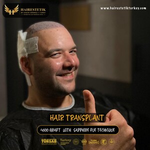 Image of Hairestetik Turkey Hair Transplant Center Gallery 3