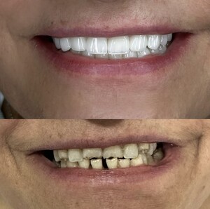 Image of Dental Care Before and After