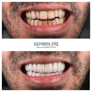 Image of SembolDiş Oral an Dental Health Polyclinic Gallery 2