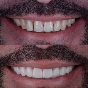 Image of Smile transformation