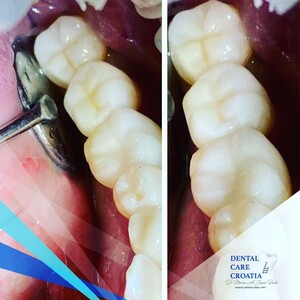 Image of Dental Care Croatia Gallery 3