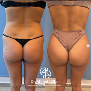 Image of Op. Dr. Ahmet Dilber Clinic Gallery 1