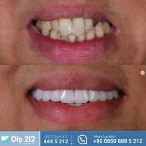 Image of Diş 212 - Dental Aesthetic Facility Gallery 1