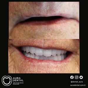 Image of Aura Dental Gallery 1