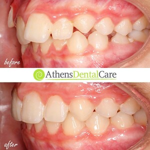 Image of Athens Dental Care Gallery 2