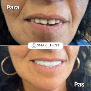 Image of Smile makeover