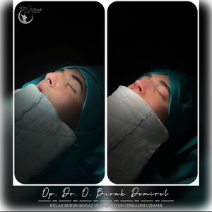 Image of Op Dr Burak Demirel ENT and Facial Aesthetics Clinic Gallery 0