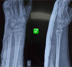 Image of Orthopedic X-Ray