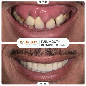 Image of Dr. Joy Dental Clinic Gallery 1