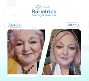 Image of Bariatric surgery before and after