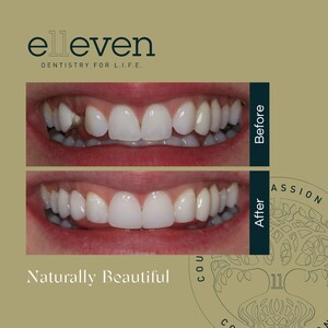 Image of Elleven Dental Gallery 1