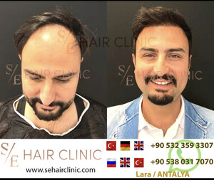 Image of SE Hair Clinic Gallery 3