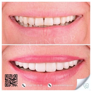 Image of Tuncer Oral and Dental Health Clinic Gallery 2