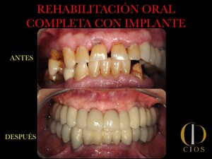 Image of Seville Oral Implantology Center Gallery 3