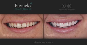 Image of Clinica Dental Puyuelo Gallery 3