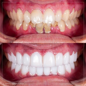 Image of Dental Design Turkey Gallery 1