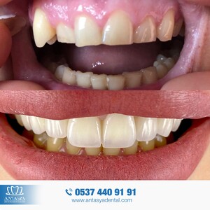 Image of Antasya Dental Gallery 1