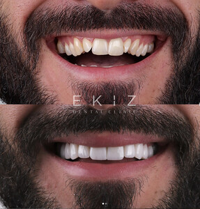 Image of Ekiz Dental Clinic Gallery 0