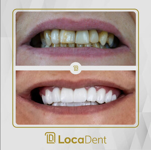 Image of LocaDent Dental Clinic Bayrakli Gallery 0