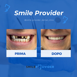 Image of Dental implants - Smile Provider