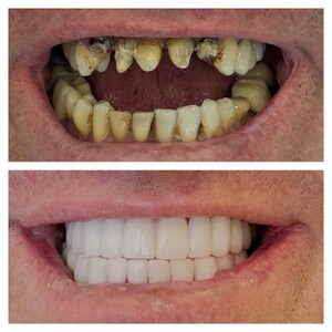 Image of Smile Design - Dent Medica Bodrum