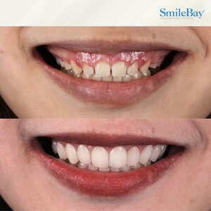 Image of Smilebay Dental Gallery 2