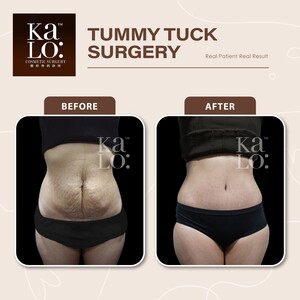 Image of KALO Cosmetic Surgery Gallery 1