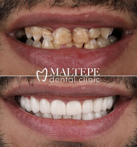 Image of Maltepe Dental Clinic Gallery 3