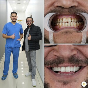 Image of Yesilyurt Dental Gallery 2