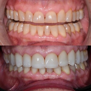 Image of Smile Makeover - Warsaw Dental Academy