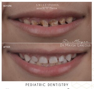 Image of Pediatric dentistry