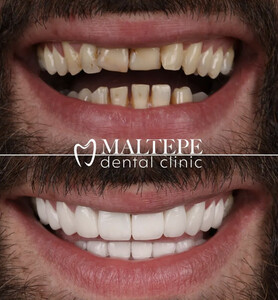 Image of Maltepe Dental Clinic Gallery 1