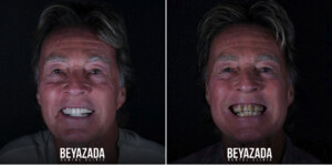 Image of BeyazAda Dental Clinic Gallery 0