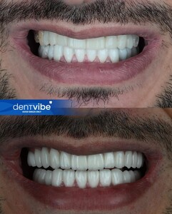 Image of Smile makeover