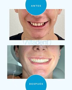 Image of Smile makeover