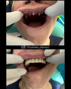 Image of Brahimi Dental Gallery 0