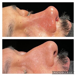 Image of Dr. Rıdvan Büdün- Rhinoplasty Istanbul Gallery 3