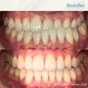 Image of Smilebay Dental Gallery 3