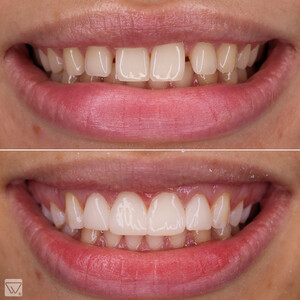 Image of Dental treatment - Delta Clinic Dent