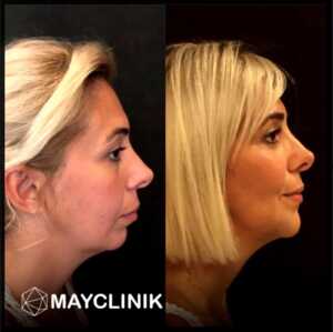 Image of MayClinik Plastic Surgery Gallery 0