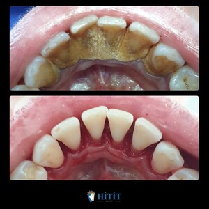 Image of Hitit Dental Gallery 3