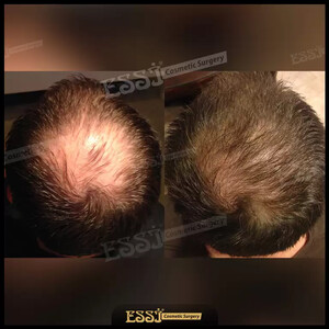 Image of Essi Hair Transplant Clinic Gallery 3