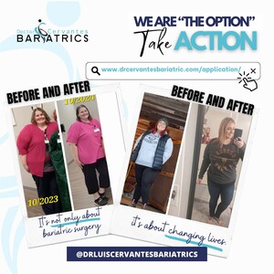 Image of Before and after bariatric surgery