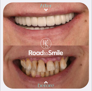 Image of Road to Smile Gallery 2